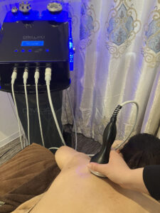 キャビテーションの機械と肩コースの様子